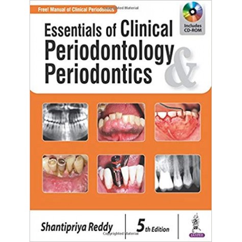 Essentials of Clinical Periodontology & Periodontics Paperback – 30 Nov 2017by Shantipriya Reddy (Author)