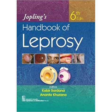 Jopling's Handbook of Leprosy Hardcover – 2020 by Kabir Sardana (Author), Ananta Khurana (Author)