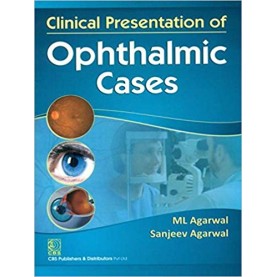 Clinical Presentation of Ophthalmic Cases Paperback-2012 by M L Agarwal (Author), Sanjeev Agarwal (Author)