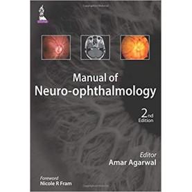 Manual Of Neuro-Ophthalmology Paperback-2015 by Agarwal Amar (Author)