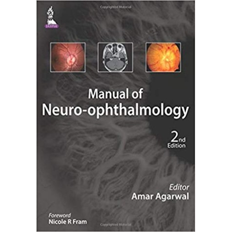 Manual Of Neuro-Ophthalmology Paperback-2015 by Agarwal Amar (Author)