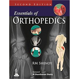 Essentials Of Orthopedics Paperback – 2014 by Shenoy Rm (Author)
