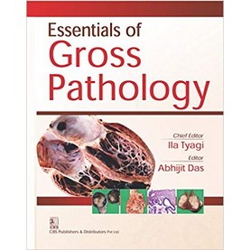 Essentials Of Gross Pathology Paperback – 16 Nov 2017by Tyagi (Author)