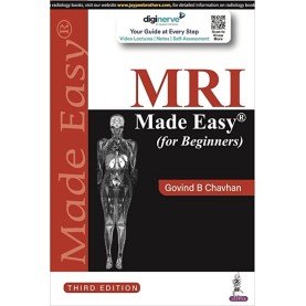 MRI Made Easy (for Beginners) Paperback – 26 May 2022 by Govind B Chavhan  (Author)