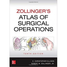 Zollinger's Atlas of Surgical Operations, Tenth Edition Hardcover-16 May 2016by Robert Zollinger (Author), E. Ellison (Author)