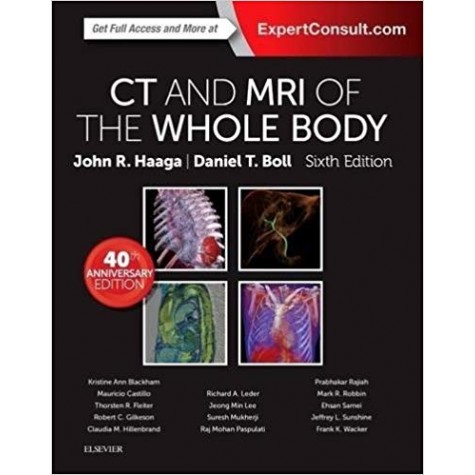 CT and MRI of the Whole Body, 2-Volume Set Hardcover-2 Aug 2016by John R. Haaga MD FACR FSIR FSCBT FSRS (Author), Daniel Boll MD FSCBT (Author)