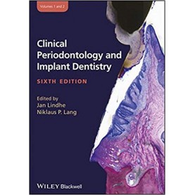 Clinical Periodontology and Implant Dentistry, 2 Volume Set Hardcover-5 Jun 2015by Niklaus P. Lang (Editor), Jan Lindhe (Editor)