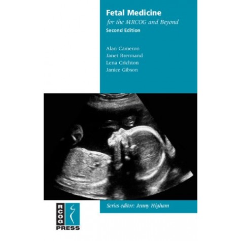 FETAL MEDICINE FOR THE MRCOG AND BEYOND, 2/E, 2012 Paperback – 31 Dec 2011by ALAN CAMERON (Author)